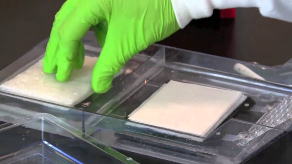 The Western Blotting Technique Understood