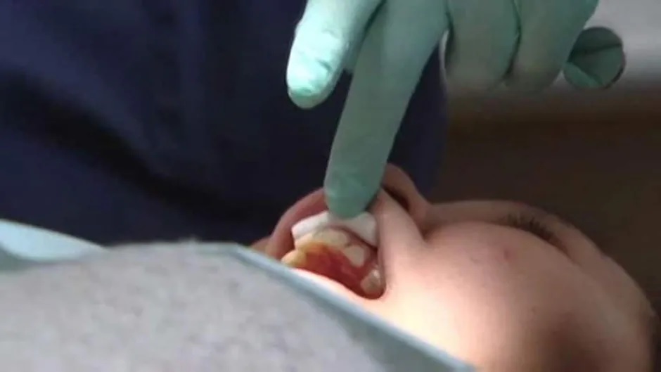 Iqaluit Dental Clinic Delves into How Deep the Connection is Between Gum Disease And COVID-19 Complications?