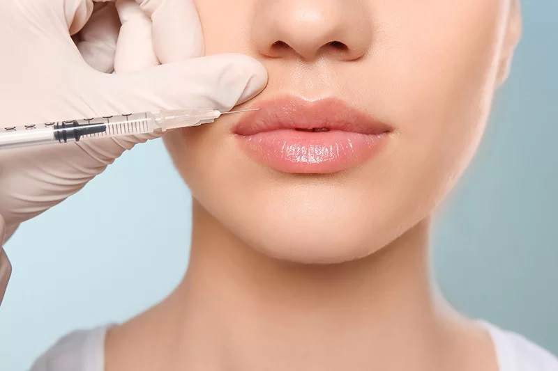  Here Are the Dos and Don’ts When You Get a Lip Injection